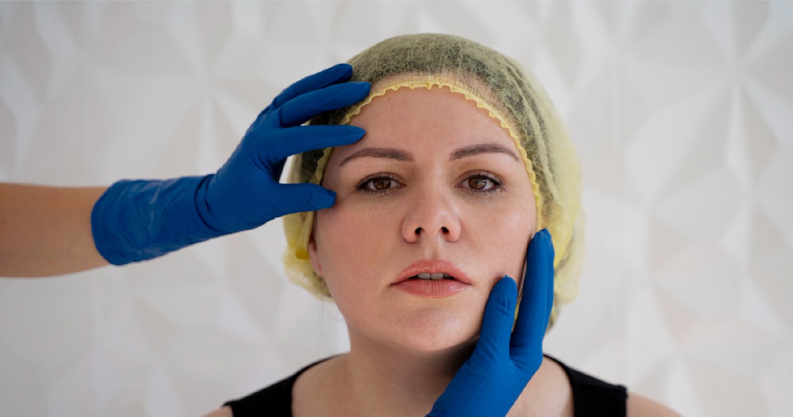 Facial Implant Surgery in Bangalore